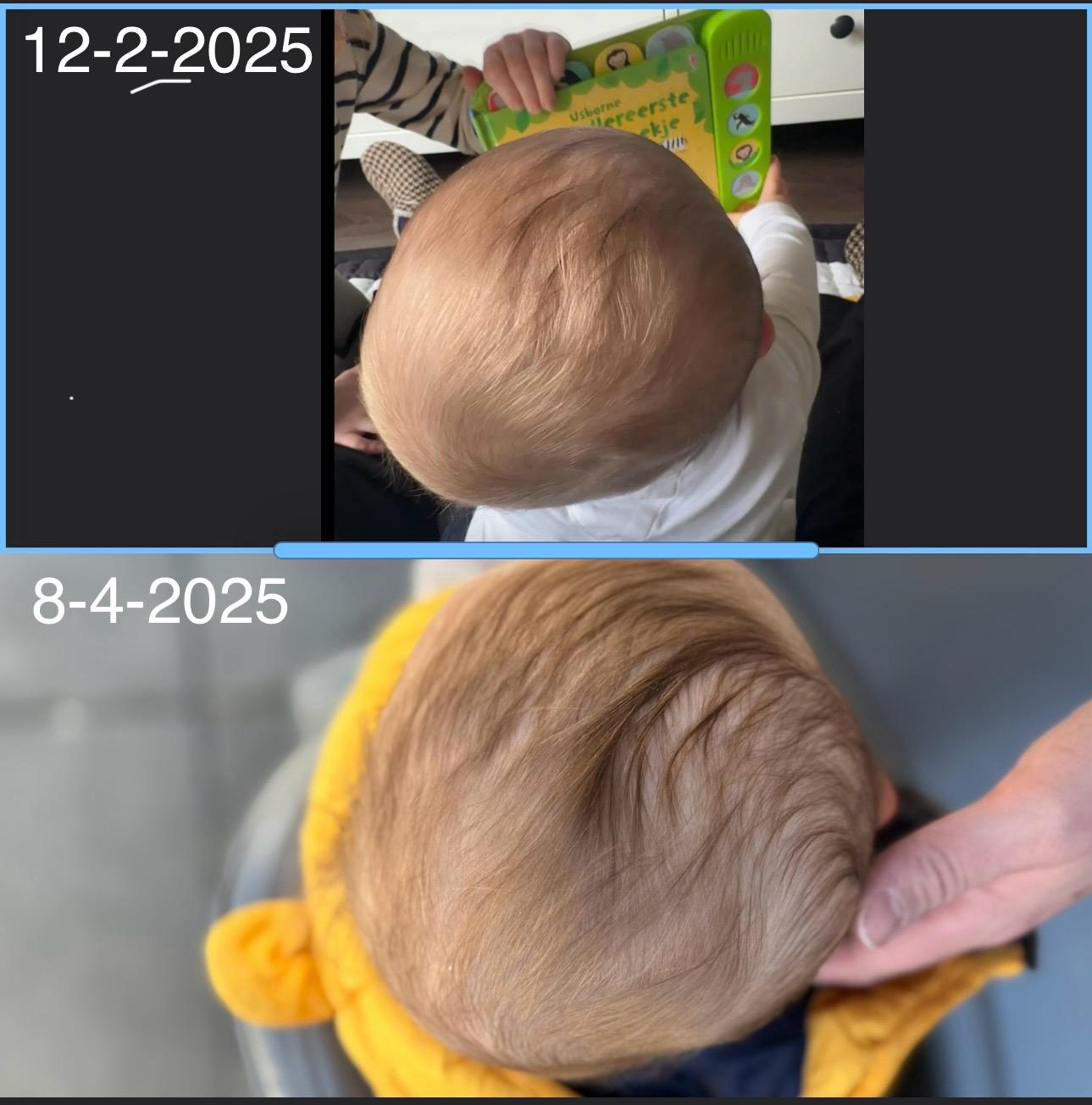 resultaat redressiehelm